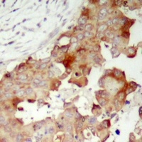 Anti-POTEB Antibody