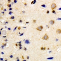 Anti-NEK7 Antibody