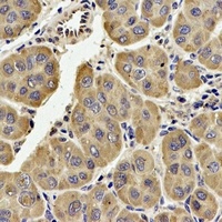 TECR antibody