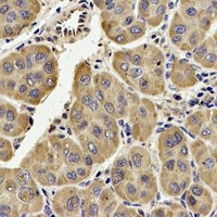 Anti-TECR Antibody