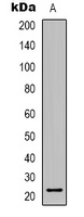 TCEAL6 Antibody