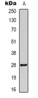 14-3-3-pan (Acetyl-K51/49) Antibody