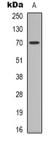 HSP72 (Acetyl-K246) Rabbit Polyclonal Antibody