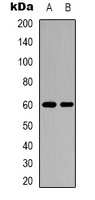 Importin alpha 2 Antibody