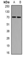 Ku70 (Acetyl-K539) Rabbit Polyclonal Antibody