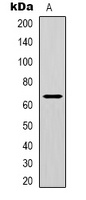 NRF2 (Acetyl-K599) Rabbit Polyclonal Antibody