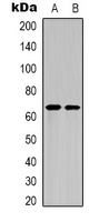 NF-kappaB p65 (Acetyl-K122) Rabbit Polyclonal Antibody