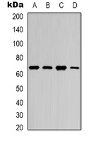 NF-kappaB p65 (Acetyl-K218) Rabbit Polyclonal Antibody