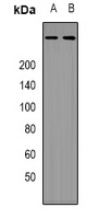 p300 Rabbit Polyclonal Antibody