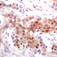 p300 Rabbit Polyclonal Antibody