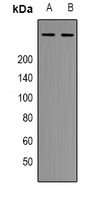 p300 Rabbit Polyclonal Antibody