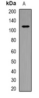 PARP1 Antibody