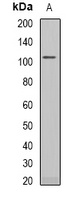 RB1 Antibody