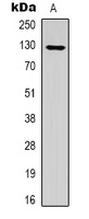 RIP140 (Acetyl-K158) Rabbit Polyclonal Antibody