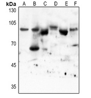 STAT3 (Acetyl-K87) Rabbit Polyclonal Antibody