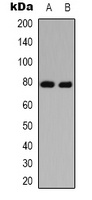 TAU (Acetyl-K686) Rabbit Polyclonal Antibody