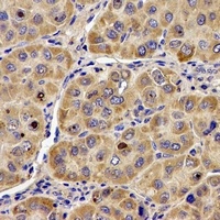 ANG Antibody