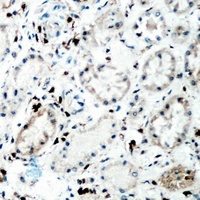 Anti-Tenascin C Antibody