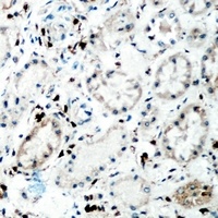 Tenascin C antibody