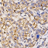 Anti-CD133 Antibody
