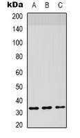 CD142 Rabbit Polyclonal Antibody