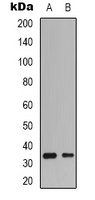 CDK4 Antibody