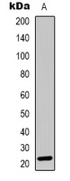 RGS1 Rabbit Polyclonal Antibody