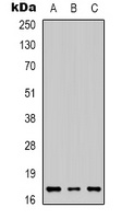 IL-1 beta Rabbit Polyclonal Antibody
