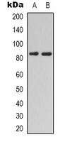HGF Rabbit Polyclonal Antibody
