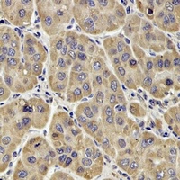 Anti-Factor XIII B Antibody