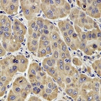 Factor XIII B antibody