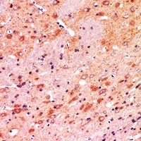 Anti-CALB1 Antibody