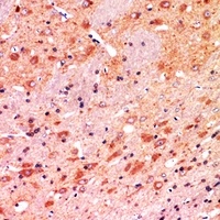 CALB1 antibody