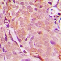 EDA antibody