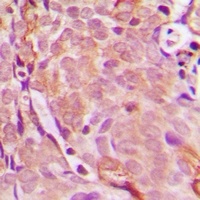 Anti-EDA Antibody