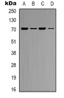 KEAP1 Rabbit Polyclonal Antibody