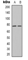 Transferrin Rabbit Polyclonal Antibody