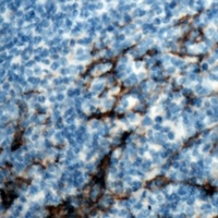 Anti-CD13 Antibody