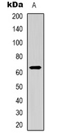 CD96 Rabbit Polyclonal Antibody