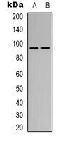 CD100 Rabbit Polyclonal Antibody