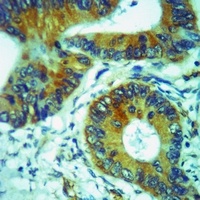 Anti-CCR6 Antibody