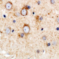 Anti-CD158e Antibody