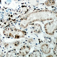 CER1 antibody