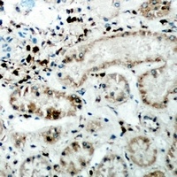 Anti-CER1 Antibody