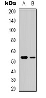 BMP3A Rabbit Polyclonal Antibody