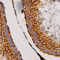 Anti-CCL27 Antibody