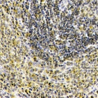 Anti-IL-1F10 Antibody