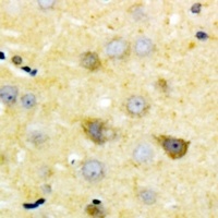 GDF7 Antibody