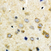 Anti-NODAL Antibody