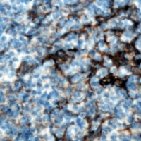 CMTM8 antibody